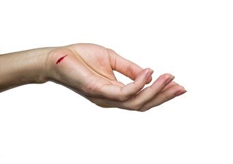 hand with a cut