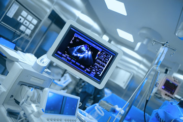 Ultrasonic monitoring of patient's heart during cardiac surgery