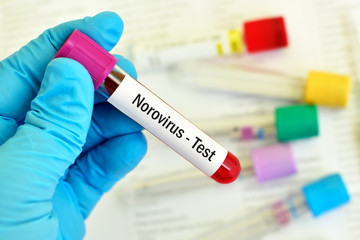 Obraz premium Test tube with blood sample for Norovirus test