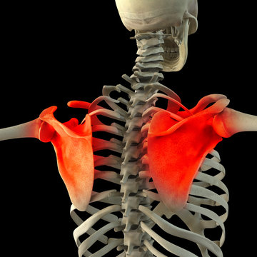 Skeletal shoulder pain isolated on black