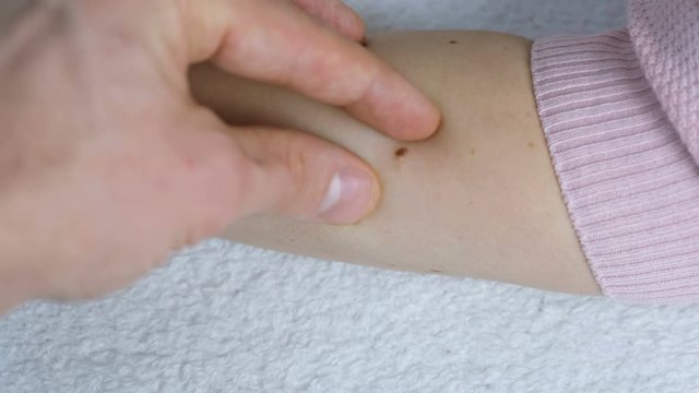Man's hand touches the mole on the woman's hand. Doctor medical screening. Close up hand and mole.
