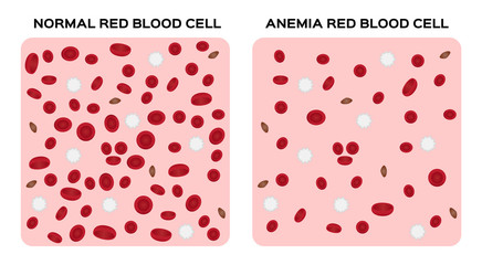 anemia vector / blood anatomy concept
