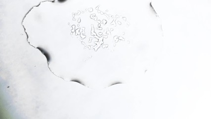 Abstract monochrome snowflake in a microscope