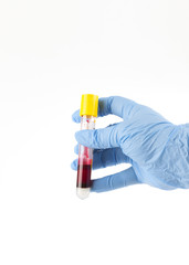 blood tube, white background