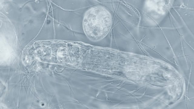 transparent microorganism under the microscope, with internal organs, as is an alien organism