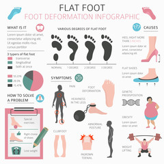 Foot deformation as medical desease infographic. Causes of Flat foot