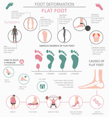 Foot deformation as medical desease infographic. Causes of Flat foot
