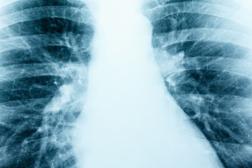 X-Ray Image Of Human Healthy Chest MRI close-up