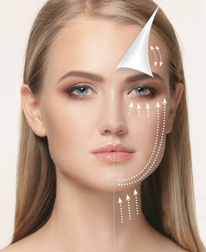 The young female face. Antiaging and thread lifting concept
