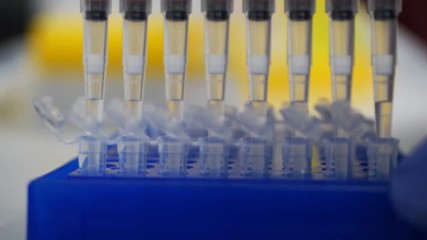 Laboratory test plate. medical researcher pipetts samples in well microplate