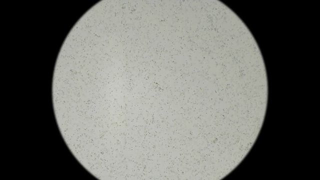 the movement of the sperm under a microscope