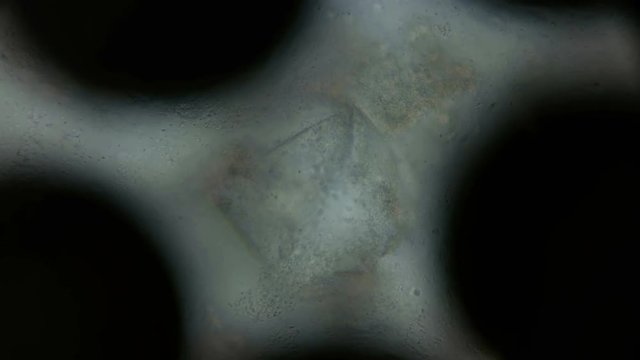 a large colony of protozoa moves under a microscope