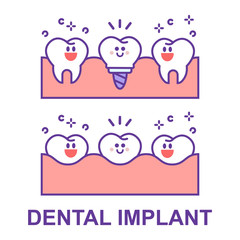 Cartoon dental implant and teeth. Smiling teeth and dental implant. Funny vector illustration