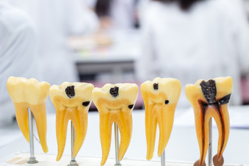 Tooth model for education in laboratory.