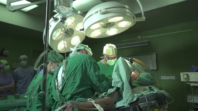 Elderly man lying on table under anesthesia with oxygen mask on head and intravenous drip injected in hand during surgeons team using surgical tools to operating patient at operation room, dolly shot