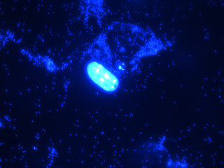 Blue fibroblast cells with bacteria contamination