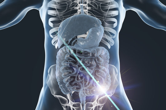 Colorectal cancer awareness medical concept. Concept of cancer treatment and prevention, 3D illustration