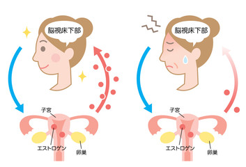 更年期障害　エストロゲン