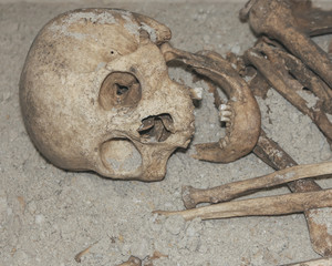 Archaeologists excavated the skeleton of a Neanderthal bones and skull with an open mouth in the ground. Prehistoric, Stone Age, Ice Age. Human remains.