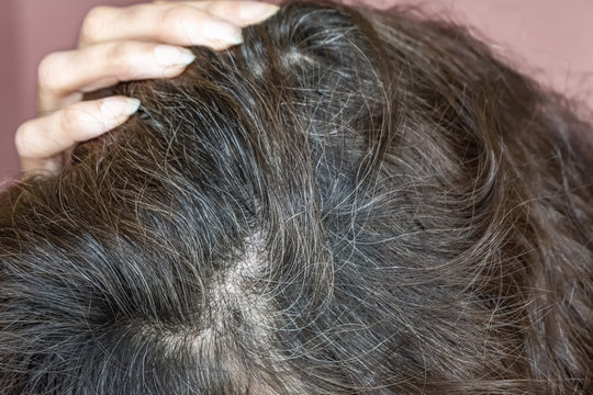 Woman Shows Her Gray Hair Roots. Going Gray.