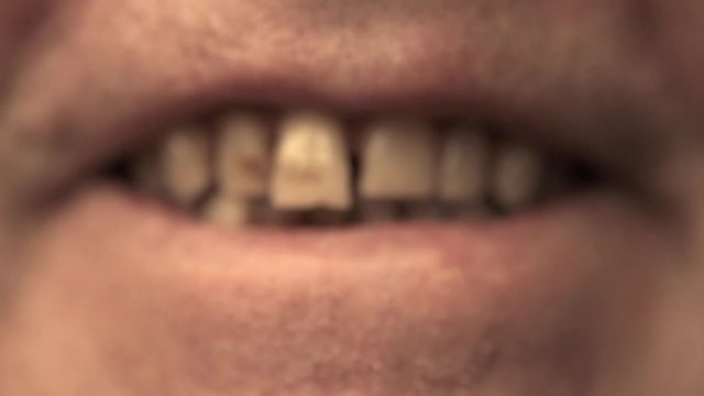 Smiling mouth of man with crooked yellow teeth close-up, selective focus