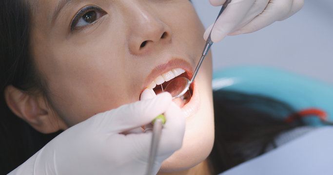 Asian Woman undergo check up of tooth in dental clinic