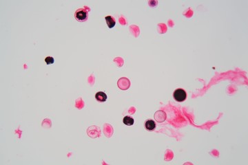Eggs of a Taenia tapeworm