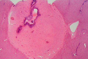Liver cells of a rabit with Coccidia parasites.
