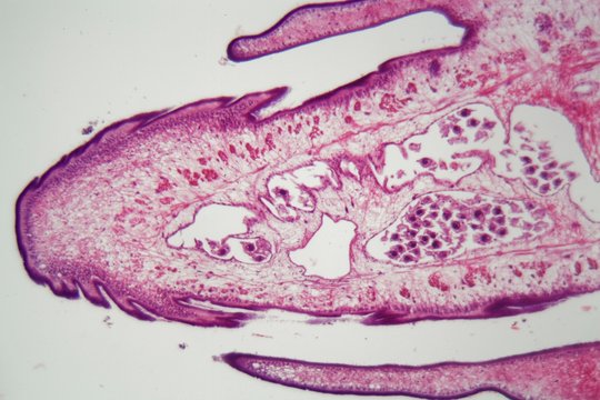 Segment of a tapeworm body (Proglottid)