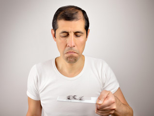 looking hair loss