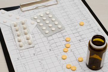 Electrocardiogram on paper.  Tablets lie on an EKG