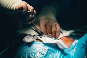 Team of surgeons in operating room. Needle holder or a needle driver in doctor's hand, a surgical...
