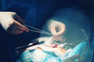 Needle holder or a needle driver in doctor's hand, a surgical instrument or a hemostat, used by...