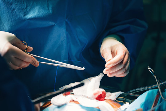 Needle holder or a needle driver in doctor's hand, a surgical instrument or a hemostat, used by surgeons with cardiac retractors, minithoracotomy retractor in minimally invasive beating-heart surgery