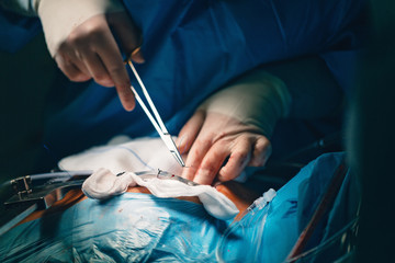 Team of surgeons in operating room. Needle holder or a needle driver in doctor's hand, a surgical...