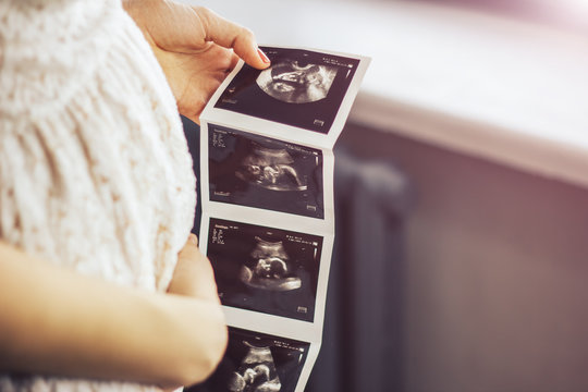 Pregnant girl holding photos of ultrasound result in hands, near window with sunlight