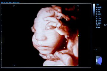 Colourful image of pregnancy ultrasound monitor
