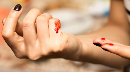 Blood on the arm from a cut with a knife