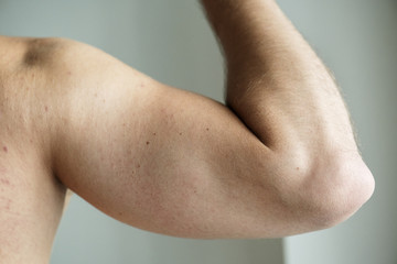 Fototapeta na wymiar Closeup of an arm of a man