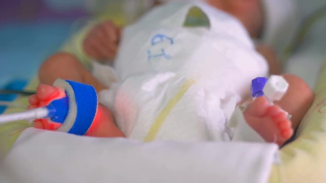 Newborn in incubator. Intensive hospital therapy: CCU, ICU, ITU.
