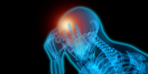 Illustration of a man suffering from migraine