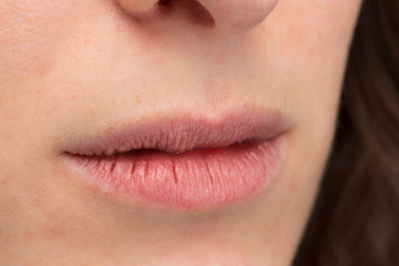 Macro of cracked dry lips of young woman - obrazy, fototapety, plakaty