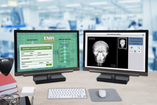 Health Information And Patient X-ray Show On Two Computer Monitors On Doctor Desk.