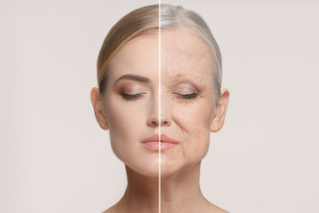 Comparison. Portrait of beautiful woman with problem and clean skin, aging and youth concept, beauty treatment