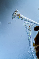 Trompetentierchen im Wassertropfen unter dem Mikroskop