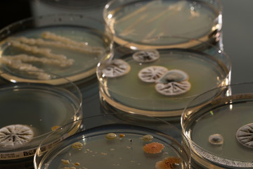 Petri dish with colonies of bacteria and fungi