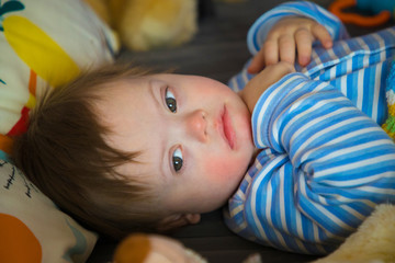 Portrait of cute baby boy with Down syndrome on the bed in home bedroom