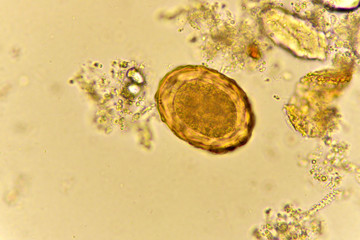 Egg of Ascaris lumbricoides (roundworm) in stool, analyze by microscope
