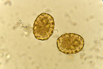 Egg of Ascaris lumbricoides (roundworm) in stool, analyze by microscope
