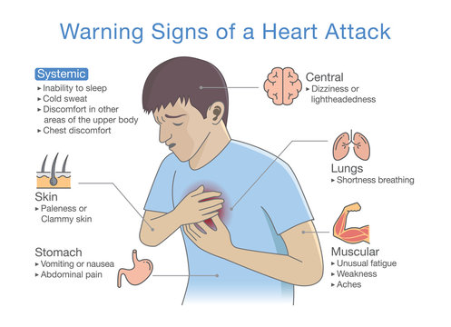 Diagram about warning signs of a heart attack. Illustration about disease symptoms when occurring.